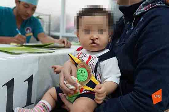 VNG và VNIF trao tặng hơn 200 triệu đồng phẫu thuật trẻ bị dị tật môi ảnh 1
